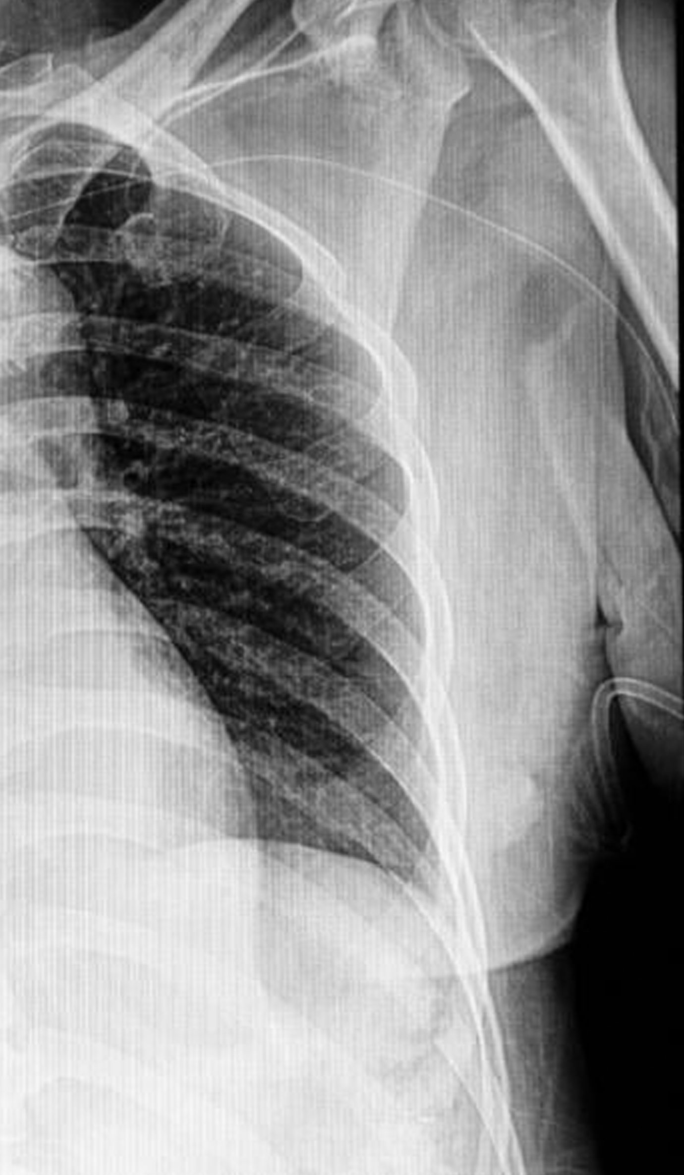 radiografia RADIOGRAFÍA CENTRO MÉDICO GAVA