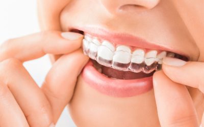 Invisalign – Centro Médico Gava en el Top 20