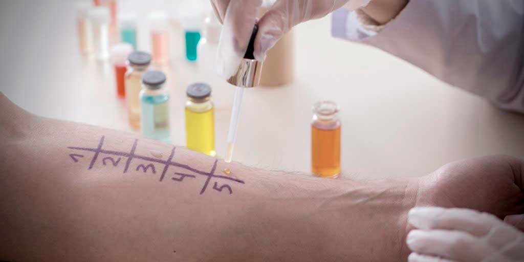 sintomas-alergia-2