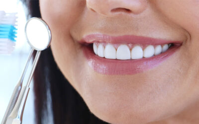 Blanqueamiento dental: Una sonrisa más brillante