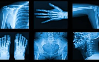 Radiografía: Una imagen rápida de tu cuerpo