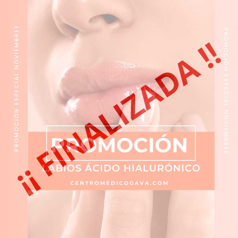 Promoción Labios Ácido Hialurónico