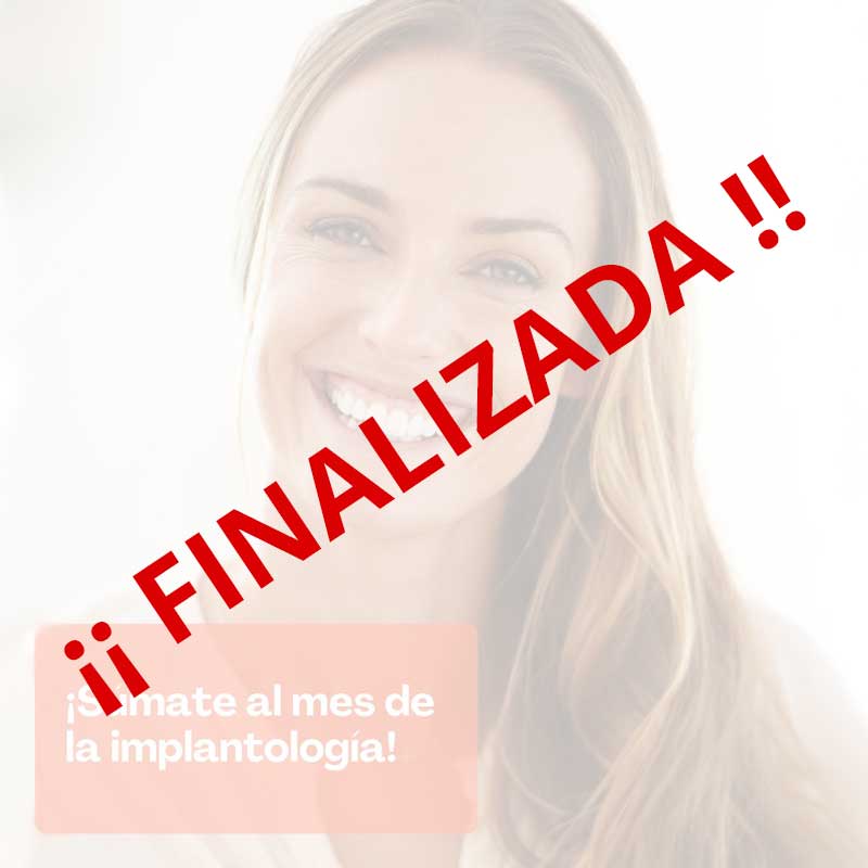 Mes de la implantología